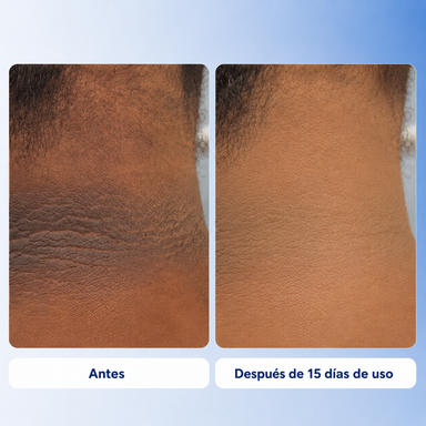 Aurae – Tratamiento Corporal Iluminador