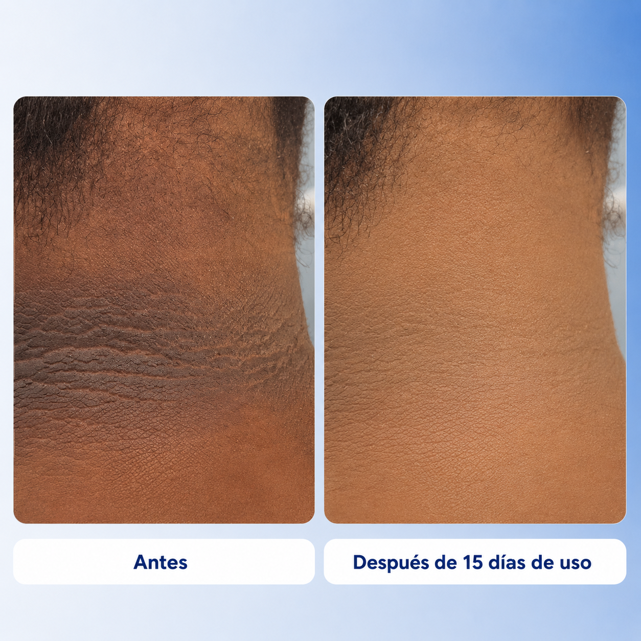 Aurae – Tratamiento Corporal Iluminador