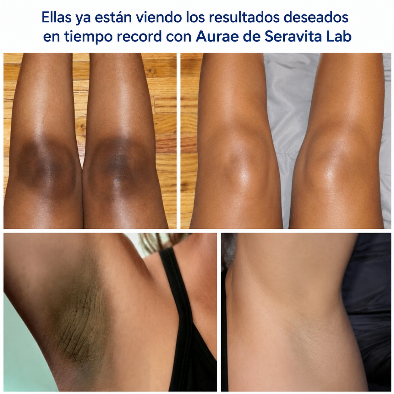Aurae – Tratamiento Corporal Iluminador