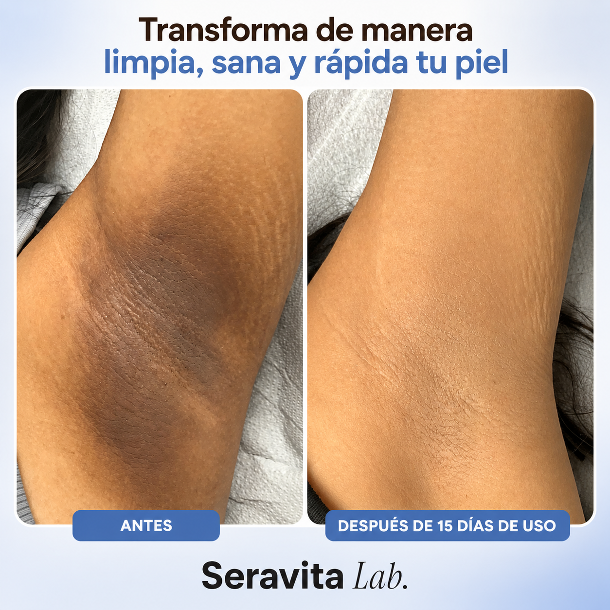 Aurae – Tratamiento Corporal Iluminador