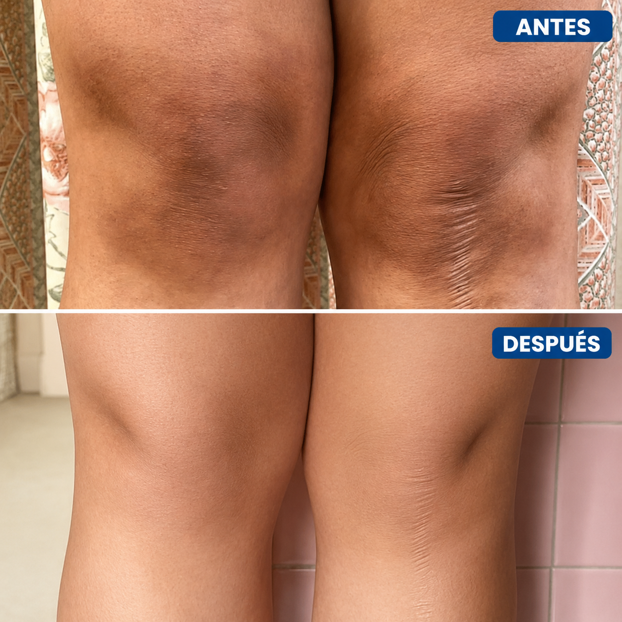 Aurae – Tratamiento Corporal Iluminador