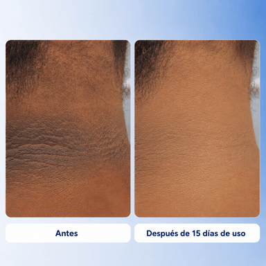 Aurae – Tratamiento Corporal Iluminador - Seravita Lab