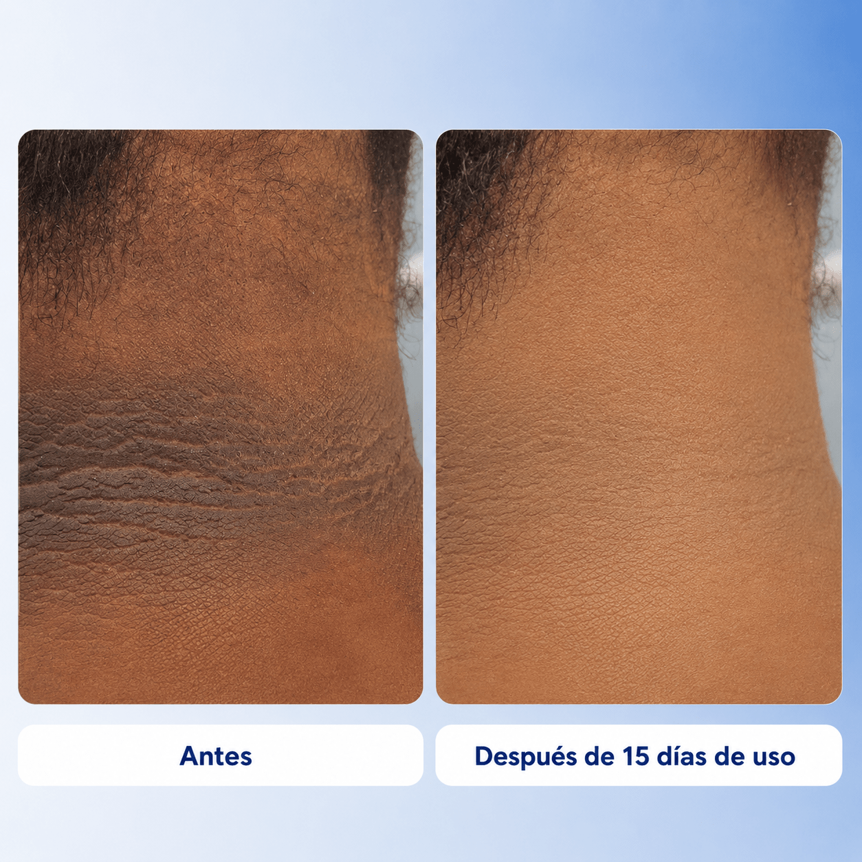 Aurae – Tratamiento Corporal Iluminador - Seravita Lab